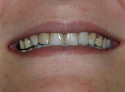 Before
